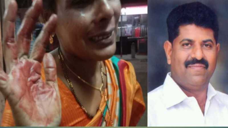 Udupi City Council member Balakrishna Shetty and his accomplices fatally assaulted woman, threatened to kill - Case registered against six persons